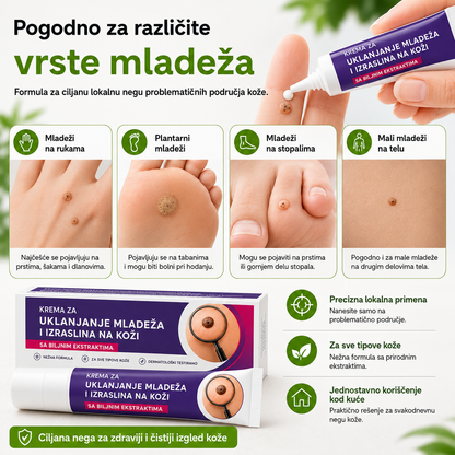 EELHOE Krema za uklanjanje mladeža