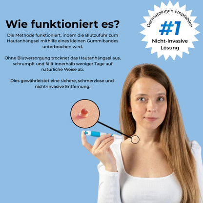 Apheliox Stielwarzen-Set