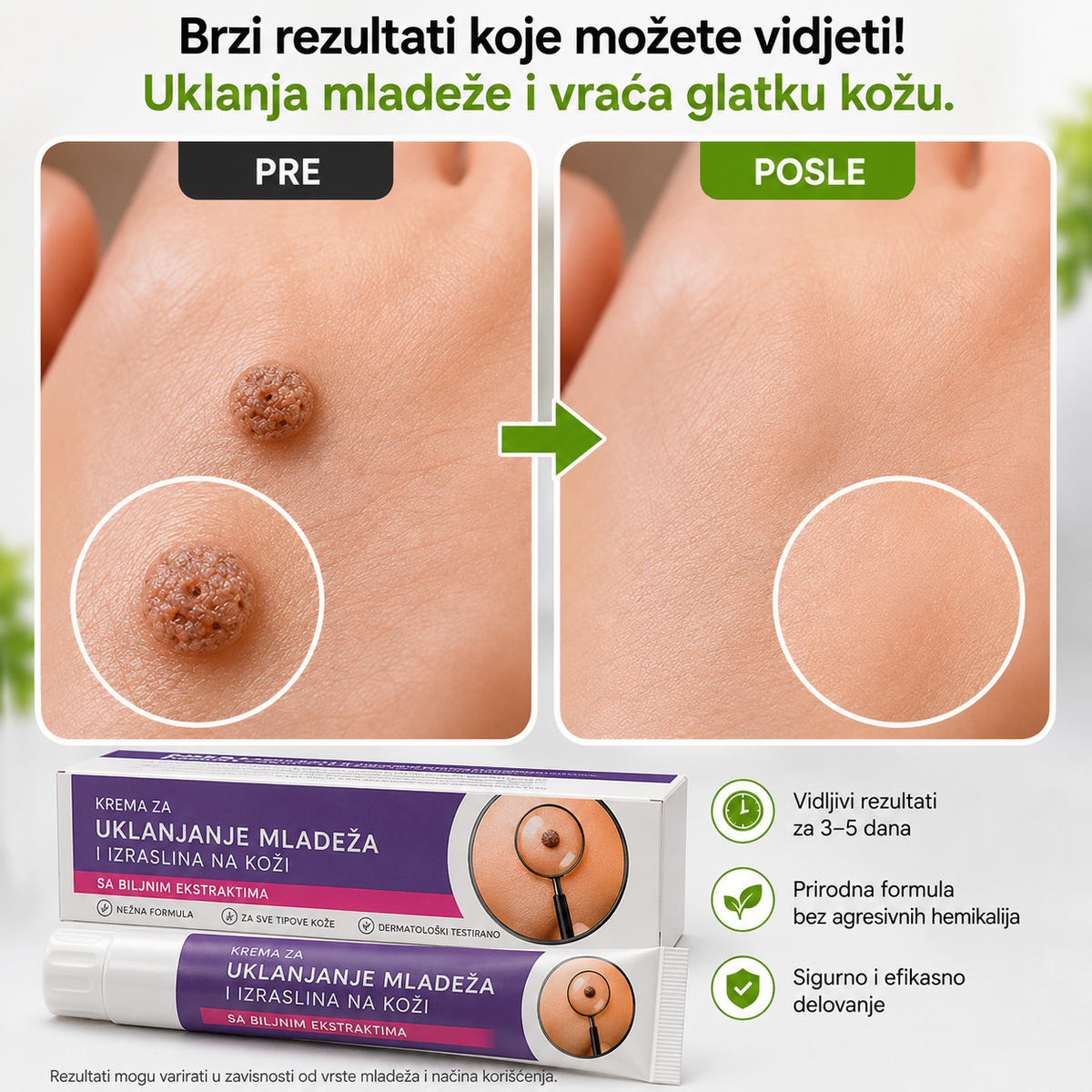 EELHOE Crema para eliminar lunares