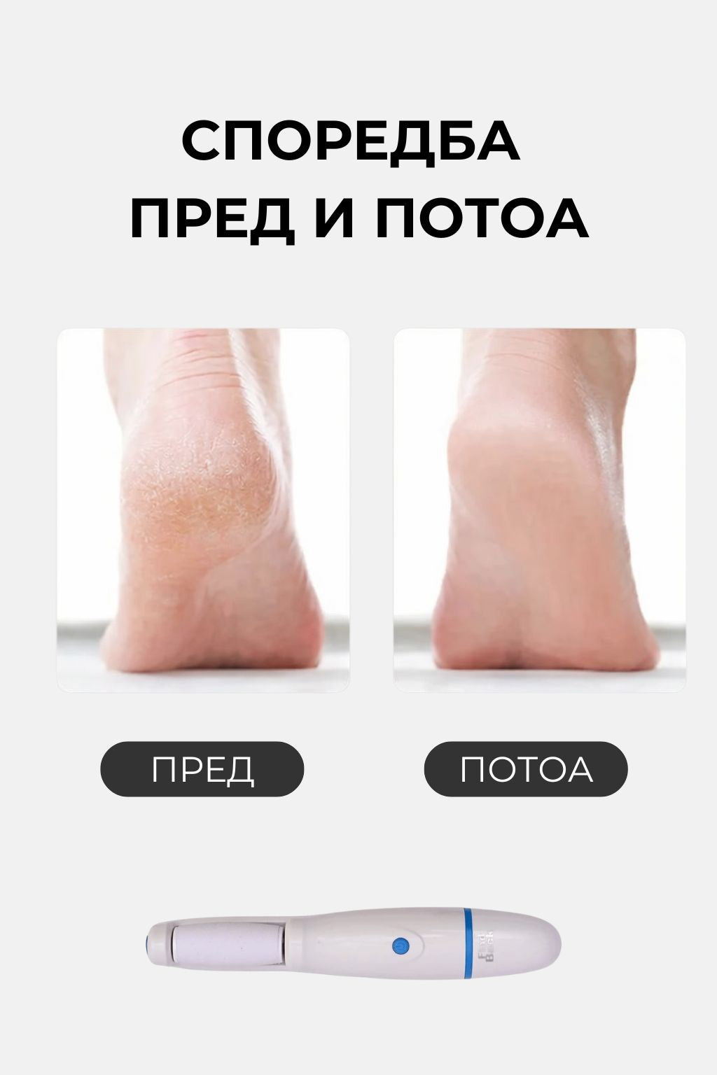 FIND BLACK™ Електрична Турпија за Пети