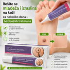 EELHOE Crema para eliminar lunares