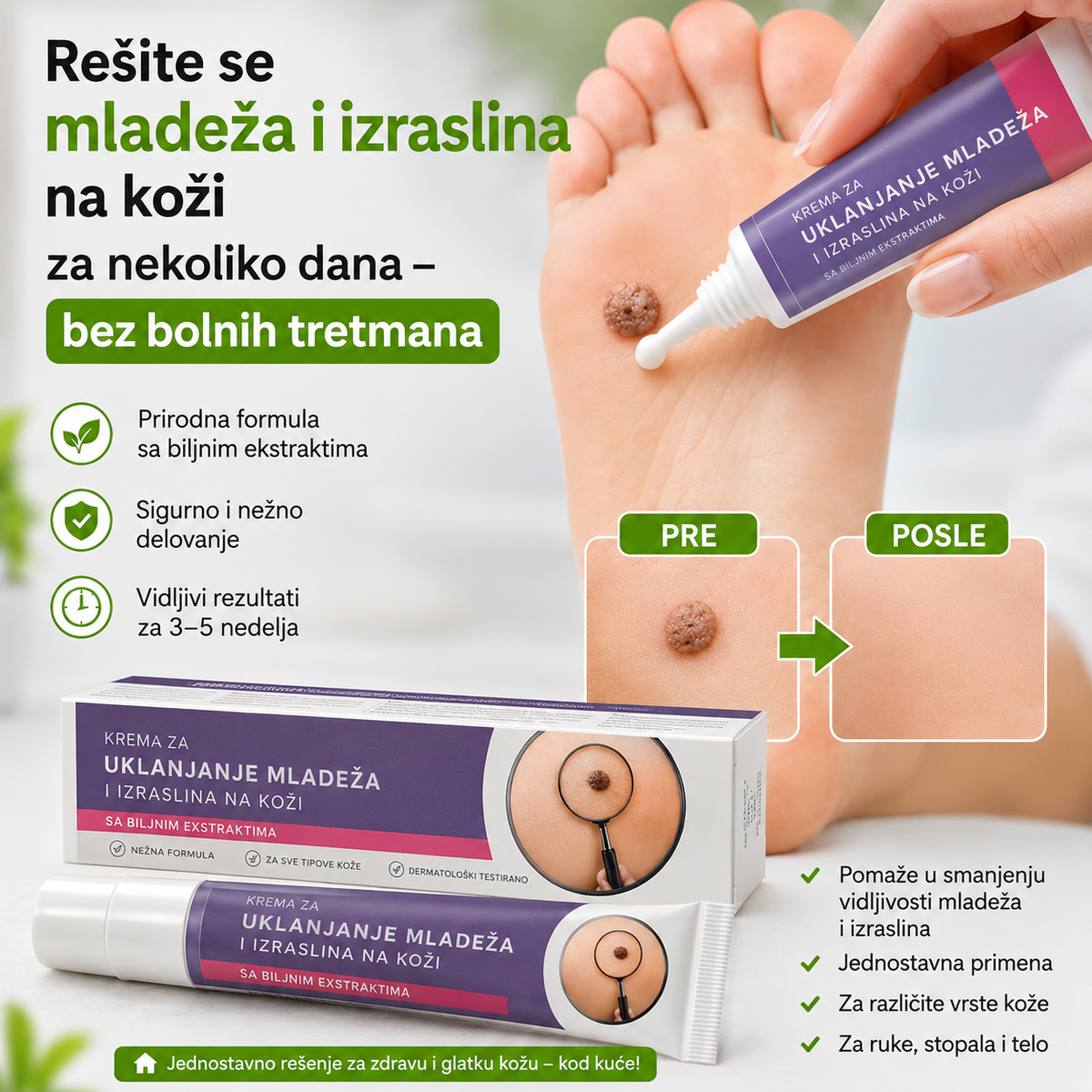 EELHOE Crema para eliminar lunares